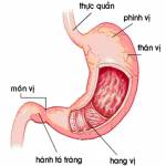 Nguyên nhân, triệu chứng của bệnh đau dạ dày